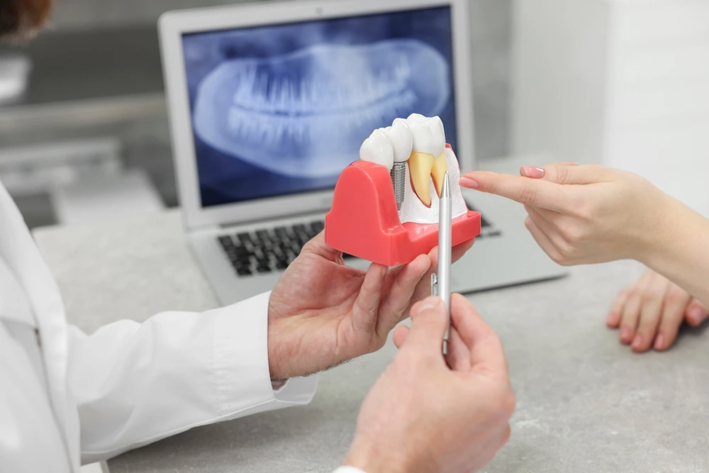 A dentist discusses a dental implant model during a patient consultation for tooth restoration at Clearly Dental Camden